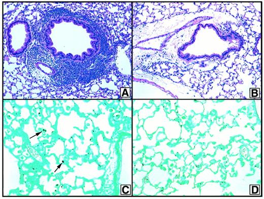 FIGURE 9. Representative photomicrographs of hematoxylin and eosin (A and B)- and GMS (C and D)-stained whole lung sections from A. fumigatus-sensitized CBA/J mice at day 7 after an intrapulmonary challenge with live A. fumigatus conidia combined with 5.0 × 108 PFU of either AdLacZ or AdMCP-1/CCL2. Peribronchial inflammation was markedly greater in lung sections from CBA/J mice that received conidia and AdLacZ (A) compared with control mice that received conidia and AdMCP-1/CCL2 (B). GMS-stained conidia were present in lung sections from control mice at day 7 after the conidia challenge (arrows, C), but were absent from similar sections from anti-MCP-1/CCL2-treated mice (D). Original magnification, ×200 for A and B and ×400 for C and D.