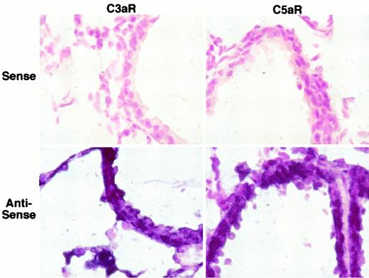 FIGURE 2. Staining of normal mouse lung for C3aR and C5aR mRNA expression by in situ hybridization. Lung sections from wild-type mice were hybridized with mouse C3aR or C5aR antisense riboprobes or with mouse C3aR or C5aR sense riboprobes as negative controls. The sections shown are ×63 magnification.