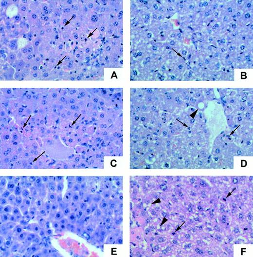 FIGURE 2. Characteristic features of hepatocellular necrosis and injury in C5−/− mice. High-power photomicrographs of hematoxylin/eosin-stained liver sections from C5+/+ and C5−/− mice at various times after CCl4 injury. A, C, and E, C5+/+ livers at 36, 48, and 72 h after injury, respectively. B, D, and F, C5−/− livers at 36, 48, and 72 h after injury, respectively. Marked apoptotic activity is observed in C5+/+ livers at 36 h, as shown in A (arrows indicate apoptotic hepatocytes). Less apoptosis is observed in C5−/− livers at the same time point (B, arrow indicates apoptotic cell). Marked shrinkage of necrotic areas and prominent regenerative activity is observed in C5+/+ livers at 48 h (C, arrows indicate apoptotic hepatocytes). Considerable fat deposition (large arrowhead) and apoptosis (small arrows) is observed in C5−/− livers at 48 h after injury (D). Marked basophilic staining of hepatocytes and karyomegaly (increased nuclear size) are prominent in C5+/+ livers at 72 h (E), indicating a brisk regenerative response to injury. All of these features are absent from C5−/− livers at 72 h after injury (F). In contrast, C5−/− livers show persisting fat accumulation (large arrowheads), eosinophilic staining indicative of hepatocyte necrosis, and increased apoptosis (small arrows) throughout the parenchyma.