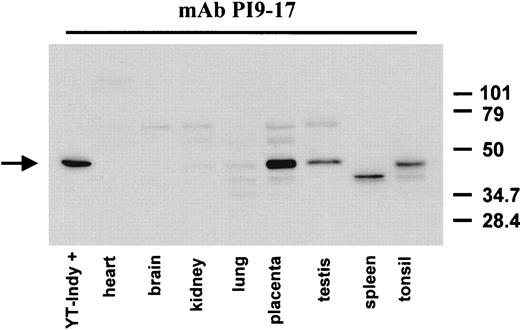 FIGURE 4. PI9 tissue distribution on Western blot. Five 5-μm thick sections of the indicated tissues were dissolved in 50 μl PBS plus 1% Nonidet P-40. Equal amounts of lysate protein (5 μg) were separated by 10% SDS-PAGE and analyzed by immunoblotting with mAb 17. For control purposes, 0.5 μl of 10-times-diluted lysate of YT-Indy cells, lysed in the presence of protease inhibitor mixture, were applied. The position of the molecular mass marker bands is indicated on the right.