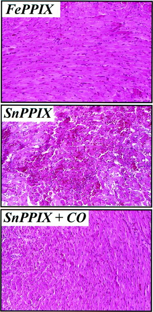 FIGURE 6. Exogenous CO suppresses myocardial infarction associated with the rejection of mouse hearts transplanted under SnPPIX treatment. Mouse cardiac grafts were harvested 3 days after transplantation (n = 3–6 per group) into CVF plus CsA-treated rats. When indicated, graft recipients were treated with FePPIX or SnPPIX and exposed to CO (250–400 ppm). Sections were stained with H&E. A representative field (magnification ×200) in the septal wall is illustrated for each treatment. Similar results were observed for left ventricular wall sections (data not shown).