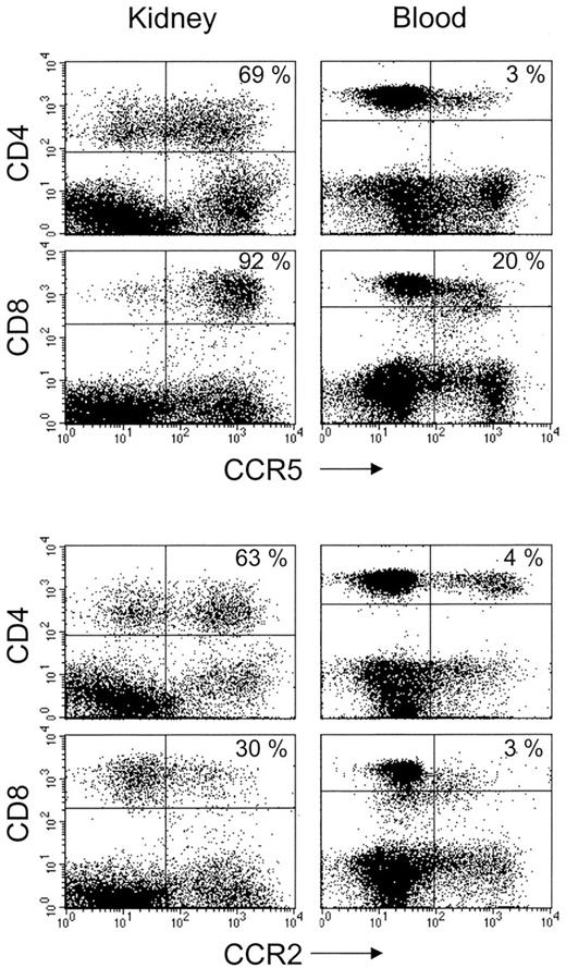 FIGURE 8. Accumulation of CCR5- and CCR2-positive T cells in the inflamed kidneys during immune complex-induced nephritis. Expression of CCR5 and CCR2 was determined by FACS analysis on leukocytes obtained from the peripheral blood (right) and the kidneys (left) of mice with apoferritin-induced glomerulonephritis.