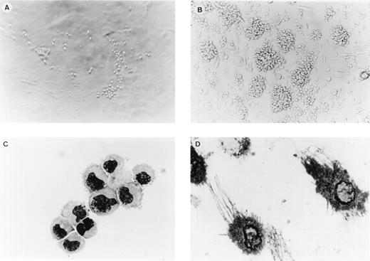 FIGURE 1. Development of TDC cultures. A-D, Photomicrographs of cell cultures. A, localized development of rounded cells in contact with fibroblasts at day 7 of culture. B, Numerous large clusters adherent to developing stroma after 14 days of culture. C, May-Grünwald-Giemsa staining of cells at day 14 of culture showing a homogeneous population of cells with irregular membranes and bean-like nuclei. D, MHC class II staining of cells at day 14. Cells display typical processes with beaded structures. Magnification ×80 for A and B, ×800 for C and D.