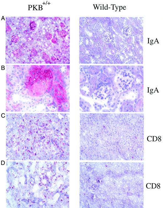FIGURE 5. Spontaneous lymphocyte infiltration and high IgA in organs from PKB+/+ mice. Organs from mice with early stage disease and age-matched wild-type controls were analyzed by immunohistochemistry. A and B, Kidney sections stained with anti-IgA shown at ×200 and ×400 magnification, respectively. Sections from the liver (C) and salivary glands (D) of PKB+/+ transgenic and age-matched wild-type control mice analyzed using anti-CD8 Abs.