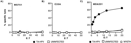 FIGURE 3. Variation among HLA-A*0201+ carcinoma cells in processing and presentation of the HPV16 E629–38 epitope. Clone 3C11 was assayed against 51Cr-labeled HPV18+ MS751 cells (A) and HPV-negative C33A cells (B) and MDA231 breast carcinoma cells (C) that were uninfected (□) or infected with TA-HPV (•). Both MS751 and C33A cells were also tested in the presence of HPV16 E629–38 peptide, with specific lysis of 69 and 37%, respectively, at the top E:T.