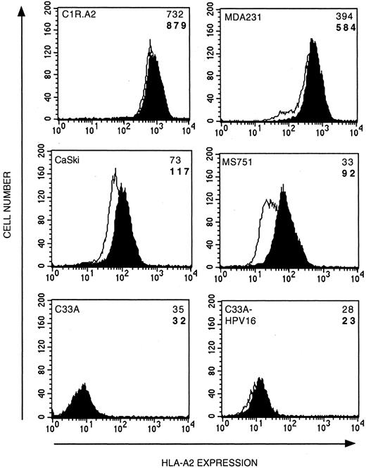 FIGURE 4. Cervical carcinoma cell lines express low or intermediate levels of cell surface MHC class I molecules that can be up-regulated by IFN-γ. Carcinoma cell lines cultured with 200 U/ml IFN-γ for 48 h (shaded) or left untreated (open) were analyzed for HLA-A*201 expression. The mean fluorescence intensity (MFI) for each result in the presence (bold font) or absence (normal font) of IFN-γ is shown. Mean fluorescence intensity for negative controls (FITC Ab only) was between 2 and 4.