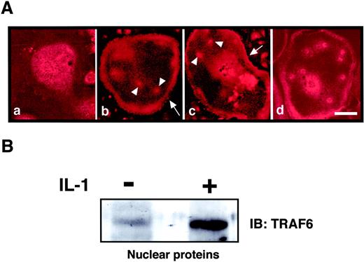 FIGURE 6. Effect of IL-1 on translocation of TRAF6 to nucleus in OCLs. A, Purified OCLs were prepared on glass coverslips, as described in Materials and Methods. After purification, cells were serum starved for 4 h, and then treated with 10 ng/ml IL-1 for 0 (a), 5 (b), 10 (c), and 30 (d) min. Cells were fixed and immunostained for TRAF6. Bars = 20 μm. B, Purified OCLs were serum starved for 4 h, and then treated with or without IL-1 (10 ng/ml) for 30 min. Nuclear proteins, prepared as described in Materials and Methods, were immunoblotted with anti-TRAF6 Ab. IB, immunoblotting.