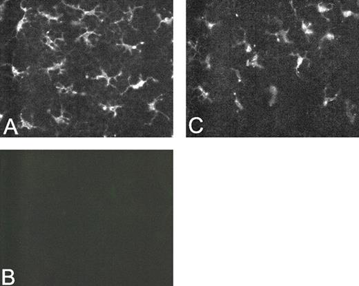 FIGURE 2. Vγ3+ DETCs are absent in the skin of IL-15−/− mice but present in the skin of IRF-1−/− mice. Epidermal Vγ3+ DETCs from 12-wk-old WT (A), IL-15−/− (B), and IRF-1−/− (C) mice were visualized by immunolabeling of epidermal sheets using FITC-conjugated anti-Vγ3 mAb. Results are representative of at least eight mice of each genotype.