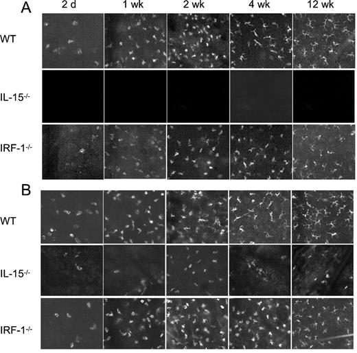 FIGURE 3. Comparison of morphological features of Vγ3+ and Thy-1+ DETCs in WT, IL-15−/−, and IRF-1−/− mice during ontogeny. Vγ3+ DETCs (A) and Thy-1+ DETCs (B) from WT, IL-15−/−, and IRF-1−/− mice were visualized by immunolabeling of epidermal sheets using FITC-conjugated anti-Vγ3 mAb or FITC-conjugated anti-Thy-1 mAb. Results are representative of at least eight mice of each genotype.