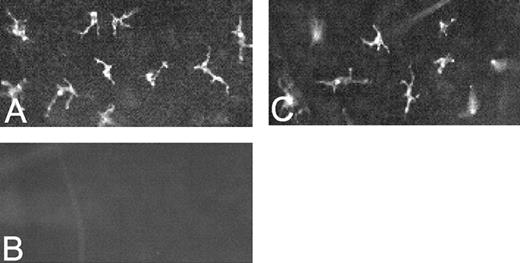 FIGURE 6. Adoptive transfer of WT and IL-15−/− fetal thymocytes into RAG-1−/− mice gives rise to Vγ3+ DETCs, whereas adoptive transfer of WT fetal thymocytes into IL-15−/− mice does not. WT FD18 thymocytes were i.v. injected into RAG-1−/− (A) and IL-15−/− (B) mice. IL-15−/− FD18 thymocytes were i.v. injected into RAG-1−/− mice (C). Six weeks later, Vγ3+ DETCs were visualized by immunolabeling of epidermal sheets with FITC-conjugated anti-Vγ3 mAb.