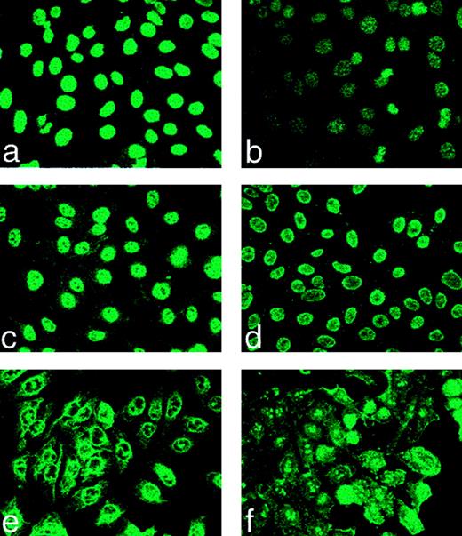 FIGURE 3. Nuclear homogeneous (a) and fine speckles (b) patterns predominated in the C+ lpr and C3null lpr mice groups, whereas several ANA patterns and occasionally mixed patterns were seen in the C4null and C3nullC4null lpr groups. HEP-2 cells were treated with dilutions of mouse serum as described in Fig. 2. Other patterns observed were nuclear matrix (c), homogenous nuclear with cytoplasmic speckles (d), nucleolar with nuclear rim (e), and nucleolar with cytoplasmic speckles (f). Results are representative of 10 different fields of view and examination of serum samples taken from at least three mice from each group. Magnification, ×100.