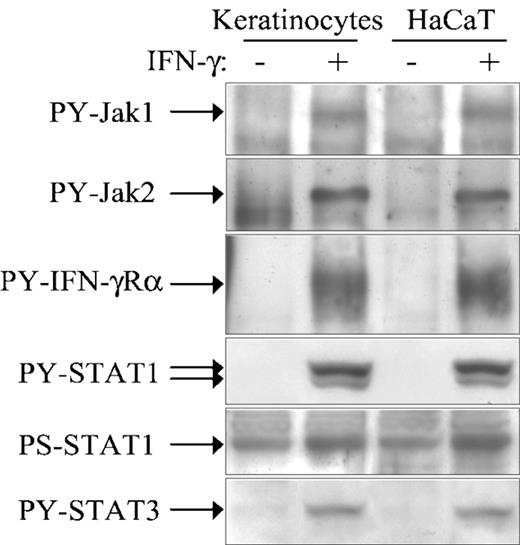 FIGURE 4. The proximal steps of IFN-γ signaling are identical in normal keratinocytes and HaCaT cells. Cultured keratinocytes and HaCaT cells were left untreated or stimulated with 200 U/ml IFN-γ for 5–15 min. Lysates were immunoprecipitated with anti-Jak1, -Jak2, and -IFN-γRα Abs and Western blotted with anti-PY Ab. Lysates were also subjected to Western blot analysis performed with anti-PY-STAT1, -PS-STAT1, and -PY-STAT3 Abs. The positions of activated Jak1 (130 kDa), Jak2 (130 kDa), IFN-γRα (90 kDa), STAT1 (91 and 84 kDa), and STAT3 (92 kDa) are indicated.