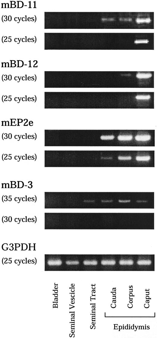 FIGURE 6. RT-PCR analysis of the regional specificity of the mBD family in the epididymis. We isolated total RNA from the mouse bladder, seminal vesicle, seminal duct, and the epididymis caput, corpus, and caudal region separately. RT-PCR detected mBD-11 and mBD-12 expression most prominent in the epididymis caput region especially after 25 cycles, and completely absent in the seminal tract, seminal vesicle, and bladder. mEP2e expression was also most prominent in the caput region, but the compatible expression was also detected in the corpus region even after 25 cycles. RT-PCR of mBD-3 showed ubiquitous expression in the caput region, corpus region, and caudal region. mBD-3 expression was detected even in the seminal tract.