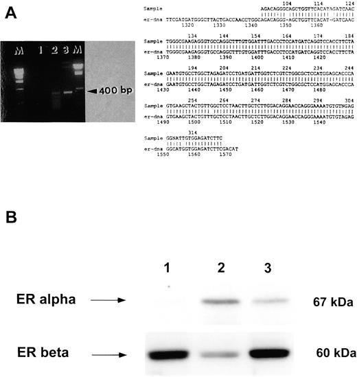 FIGURE 2. Characterization of ER expressed in monocytes and macrophages. A, Cloning and sequencing of the ER-binding site in human monocytes. The ER-binding site mRNA from MCF-7 cells (lane 2) and monocytes (lane 3) was amplified using RT-PCR. Lane 1 is negative control. The PCR product was sequenced and compared with the described ER-binding site. Note the 100% homology at the binding site between monocytes and the wild-type ER. B, Western blot analysis for the expression of ERα and ERβ. Lysates from U937 cells and PMA-differentiated U937 cells were evaluated for the expression of ERα and ERβ by Western blot using an anti-ERα mAb (clone 6F11) and an anti-ERβ rabbit polyclonal. ERβ but not ERα was detected in undifferentiated U937 cells (lane 1), while PMA-differentiated U937 cells expressed ERα and low levels of ERβ (lane 2). The human breast cancer cell line, T47D, was used as positive control for both ERα and ERβ (lane 3).