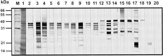 FIGURE 1. Immunoblots showing binding of patients’ serum IgE to P. monodon crude extract. Lane M, Molecular mass markers; lane 1, Coomassie blue staining of the crude extract; lanes 2–19, immunoblots showing binding of IgE from different serum samples from allergic patients; lane 20, immunoblot using serum from a nonallergic individual.
