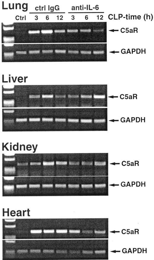 FIGURE 4. Effect of anti-IL-6 treatment on C5aR mRNA expression during sepsis. Semiquantitative RT-PCR results for C5aR mRNA in lung, liver, kidney, and heart from anti-IL-6-treated animals and nontreated animals. RT-PCR was performed using RNA isolated 0, 3, 6, and 12 h after CLP. Approximately equal loading of the DNA product is demonstrated by expression of GAPDH mRNA. Results are representative of two independent and separate experiments for each group and time point.