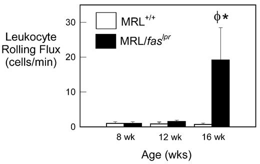 FIGURE 1. Leukocyte rolling flux in pial postcapillary venules of MRL+/+ and MRL/faslpr mice at 8, 12, and 16 wk of age. Data are shown as mean ± SEM of four to seven mice per group. φ, Denotes p < 0.05 vs 8- and 12-wk MRL/faslpr mice. ∗, Denotes p < 0.05 vs 16-wk MRL+/+ mice.