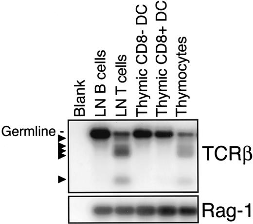 FIGURE 4. Lack of TCRβ gene D-J rearrangements in the DNA extracted from thymic DC. A PCR assay was performed using probes specific for D-J rearrangements in TCRβ genes. T cells and thymocytes served as positive controls, B cells as a negative control. Amplification of the Rag-1 gene served as a control for template loading. Two such PCR assays on the same samples used in Fig. 3 gave similar negative results, confirming earlier data using a direct Southern hybridization assay.