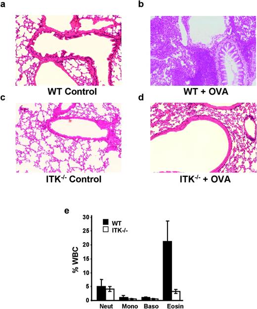 FIGURE 1. Reduced lung inflammation in mice lacking ITK following induction of allergic asthma. WT (a and b) or ITK−/− (c and d) mice were primed twice, 5 days apart with OVA/alum (c and d) or alum alone (a and c) then exposed IN to OVA (all mice) on days 12–15 as described in Materials and Methods. Twenty-four hours after the final OVA intranasal exposure, lungs from mice were fixed, paraffin-embedded, sectioned (5 μm), and stained with H&E. a, WT mouse primed with alum and exposed to OVA IN. b, WT mouse primed with OVA/alum and exposed to OVA IN. c, ITK−/− mouse primed with alum and exposed to OVA IN. d, ITK−/− mouse primed with OVA/alum and exposed to OVA IN. Note the thickening of the epithelial cell layer lining the bronchioles and inflammatory infiltration in the WT mouse primed and exposed (b) and the lack of such thickening and infiltration in the lung from the mouse lacking ITK (d). Original magnifications, ×10. e, Reduced eosinophil infiltration in the lungs of mice lacking ITK following induction of allergic asthma. Lungs from similarly treated mice were isolated and dissociated as described in Materials and Methods. The resultant cell populations were analyzed using an Advia 120 Hematology Analyzer for neutrophils (neut), monocytes (mono), basophils (baso), and eosinophils (eosin). Lymphocytes were also detected but no significant changes were detected in this population (data not shown). Profiles from the lungs of control mice profiles were similar to those seen in the ITK−/− mice and were omitted for clarity of presentation. Note the significant difference in the percentage of eosinophils in the lungs from the primed and challenged ITK−/− mice compared to WT mice (p < 0.068). Similar results were seen when control mice were primed with OVA/alum but were only exposed to PBS IN. Representative of more than seven separate experiments with at least three mice per group.