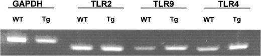 FIGURE 3. HIV-1 Tg mouse splenocytes express TLR2, TLR4, and TLR9. We isolated RNA from HIV-1 Tg mouse splenocytes and performed RT-PCR analysis as described in Materials and Methods. The results were compared with those obtained from FVB/N mice.