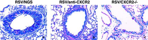 FIGURE 5. CXCR2 modulates RSV-induced goblet cell metaplasia. Lungs from RSV/NGS, RSV/anti-CXCR2, and RSV-infected CXCR2−/− mice were harvested at 12 dpi and were sectioned. PAS staining was done to identify mucus-producing cells. Images were captured at ×20 magnification. RSV infection induces goblet cell metaplasia, as indicated by magenta staining (a). Anti-CXCR2 treatment during RSV infection suppresses mucus production as evidenced by significantly fewer PAS-positive cells (b). A role for CXCR2-mediated mucus production was confirmed by results showing that the RSV infection of CXCR2−/− mice was unable to induce the extent of mucus production that was observed in RSV-infected wild-type mice (c). These results are representative of three experiments, with n ≥ 5 animals per group per experiment.