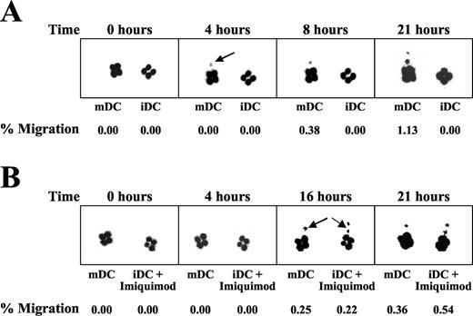 FIGURE 6. Imaging of 111In-labeled, PSA RNA-transfected DC migration as a function of time in a cancer patient. A, Imaging of 111In-labeled DC migration as a function of time in a patient injected simultaneously with PSA RNA-transfected, mature (left extremity), and immature (right extremity) DC. Migration of mature, but not immature DC could be observed 4 h following intradermal injection (arrow). Representative figure of six treated subjects. B, Mature DC were injected into untreated sites. Immature DC were injected into Imiquimod-treated skin sites, as indicated. Representative figure of two treated subjects.