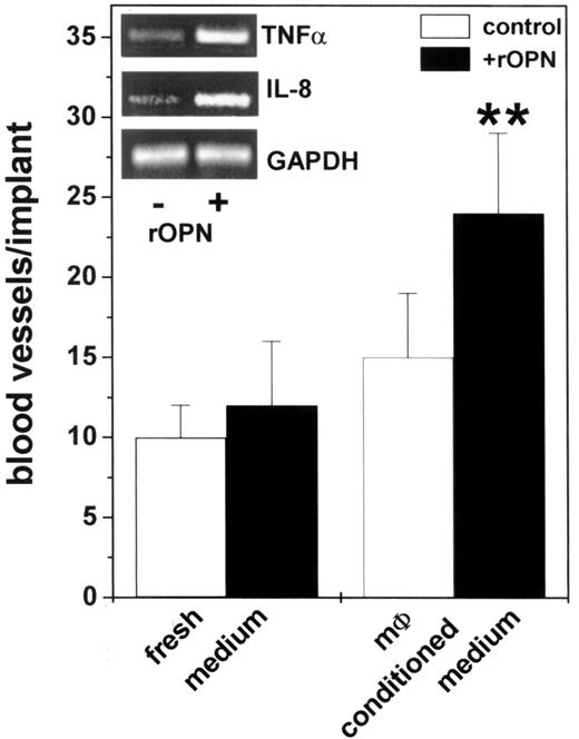 FIGURE 9. Angiogenic activity of OPN-treated human monocytes. Human monocytes (mφ) were incubated for 48 h in the absence (□) or the presence (▪) of 100 nM rOPN in serum-free RPMI. Then conditioned media were evaluated for their angiogenic activity in the CAM (3.0 μl/implant). Fresh medium with or without 100 nM rOPN was used as a negative control. ∗∗, p < 0.01 vs control. Inset, Monocytes were incubated for 4 h in the absence or the presence of 100 nM rOPN. Then RNA was extracted, and RT-PCR was performed using specific human TNF-α and IL-8 primers. Human GAPDH primers were used for the loading controls.