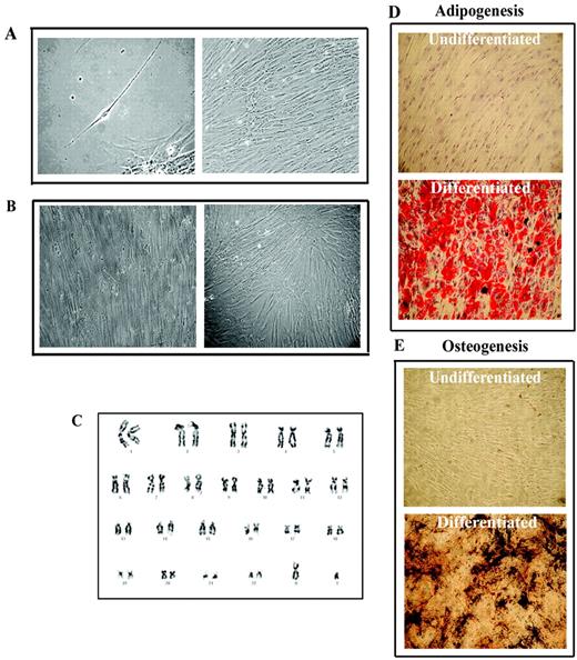 FIGURE 1. Characterization of MSC. A, Representative culture of MSC at different confluence. Magnification: left, ×40; right, ×20. B, MSC (left) and fibroblasts (right) from the same BM donor (magnification, ×20). C, Karyotype of human MSC after five passages. D and E, Representative of three experiments, each performed with a different donor. Stains for adipogenic (D) and osteogenic (E) differentiation are shown.