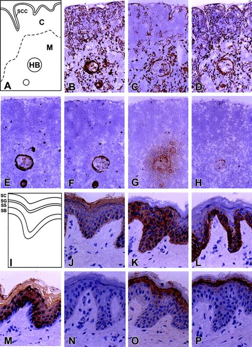 Corticosteroids Regulate Epithelial Cell Differentiation And Hassall 