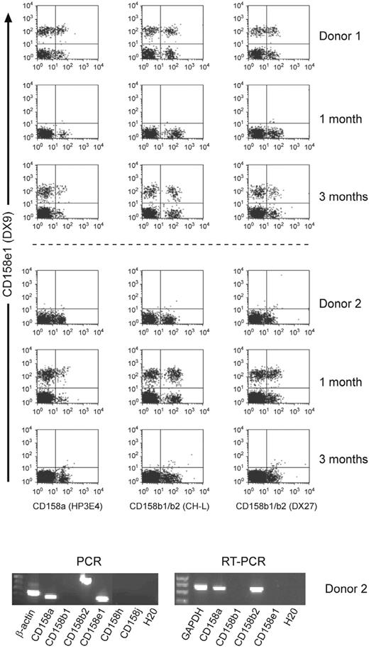 FIGURE 6. Donor-specific pattern of KIR expression resumed within 3 mo after transplantation. Illustrative patterns from two donor/recipient pairs are shown; NK cells from donor 1 constitutively expressed CD158e1; those from donor 2 did not. One month after transplantation, NK cells derived from the graft of donor 1 did not express CD158e1, whereas those from donor 2 did. The patterns of KIR expression reverted back to a pretransplant pattern within 3 mo and remained stable thereafter. RT-PCR confirmed that cells from donor 2 did not constitutively express CD158e1 transcripts; however, the CD158e1 gene was detectable by PCR using two different sets of primers for exon 3 (shown) (20 ) and exon 4 (not shown), confirmed by sequencing the PCR products. Both donors and recipients are HLA-Bw4 positive.
