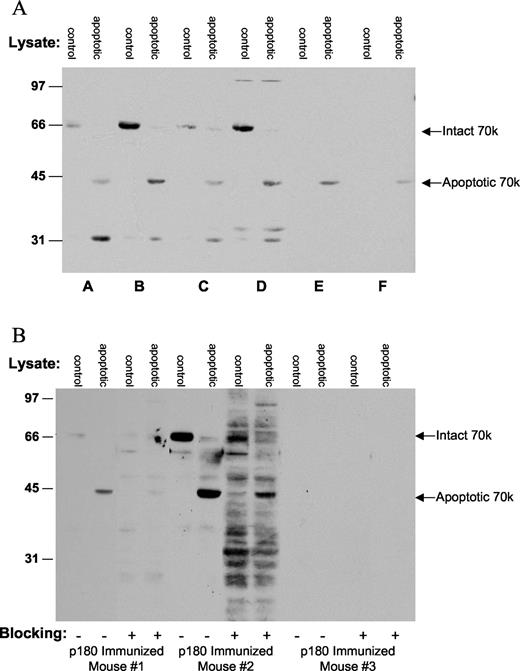 FIGURE 4. A, Response to murine immunization with the 1–205 form of U1-70 kDa. Control and apoptotic Jurkat lysates were immunoblotted with 1/1000 dilutions of sera from mice taken 1 mo after immunization with the 1–205 form of 70k. Results shown are representative of other mouse samples. The identity of the intact and apoptotic 70k bands was confirmed by comigration with 70k bands identified from intact and apoptotic Jurkat lysates using human control sera on the same gels (not shown). Mice A, B, C, and D show recognition of the intact and apoptotic forms of 70k, plus recognition of a 32-kDa activity in apoptotic but not intact lysates; mice E and F show preferential recognition of the apoptotic form of 70k. B, Immunization with the 1–180 form of 70k does not induce immunity to epitopes on apoptotic but not intact Ag forms. Sera taken 1 mo after immunization with the 1–180 70k peptide from three mice were screened by immunoblot in the presence and absence of soluble U1-70-kDa blocking Ag for recognition of the intact and apoptotic forms of 70k in Jurkat lysate as previously described (3 ). Competitive inhibition of recognition of the intact and apoptotic forms of 70k were comparable in mice 1 and 2; mouse 3 had no measurable response to 70k. Although inclusion of the peptide for competitive binding led to increased background signal (particularly with mouse 2), no additional bands were observed in apoptotic but not intact lysates.