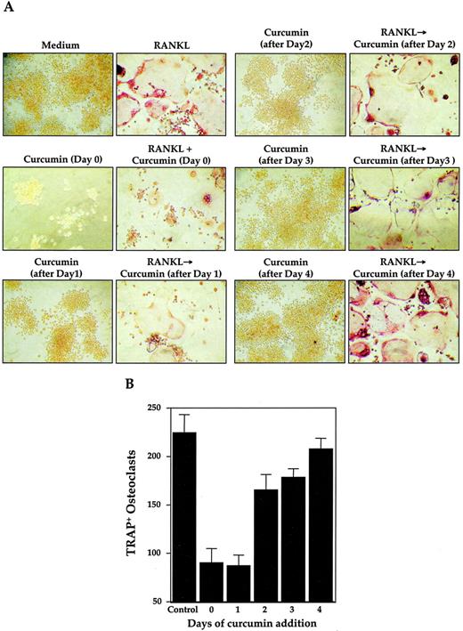 FIGURE 4. Curcumin effectively inhibits RANKL-induced osteoclastogenesis 24 h after stimulation. RAW 264.7 cells (1 × 104 cells) were incubated either alone or in the presence of RANKL (5 nM), and curcumin (10 μM) was added at the same time or after indicated time periods. Cells were cultured for 5 days after RANKL treatment and stained for TRAP expression. A, Photographs of cells (original magnification, ×100). B, Multinucleated (>3 nuclei) osteoclasts were counted. Values indicate mean of total osteoclasts in triplicate cultures (error bar indicates SD).