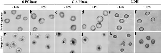 FIGURE 2. Localization of enzyme activities in neutrophils. Representative cells from nonpregnant women (top row; a–f) and pregnant women (bottom row; g–l) are shown. Neutrophils were studied with and without prior incubation with LPS (50 ng/ml, 20 min). Cells were fixed then stained for 6-PGDase (a, b, g, and h), G-6-PDase (c, d, i, and j), and LDH (e, f, k, and l) activity (26 27 ). 6-PGDase enzymatic activity is peripherally located in cells from nonpregnant women (a and b), but was found near the center of cells from pregnant women (g and h). Thus, 6-PGDase activity, in addition to its antigenic epitopes, undergoes differential trafficking in cells from nonpregnant and pregnant women. Positive and negative controls were performed using G-6-PDase activity and LDH activity, as in Fig. 1. LPS did not affect the intracellular distributions of 6-PGDase, G-6-PDase, and LDH. Thus, G-6-PDase activity parallels the distribution of G-6-PDase Ag identified in the immunofluorescence experiments above. Magnification, ×760. a–d and g–j: n = 12; e, f, k, and l: n = 5.