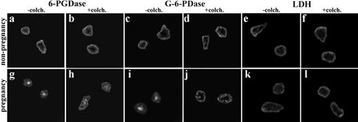 FIGURE 4. Effect of colchicine on the intracellular distribution of 6-PGDase, G-6-PDase, and LDH in neutrophils. Representative cells from nonpregnant women (top row; a–f) and pregnant women (bottom row; g–l) are shown. Neutrophils were stained without (a, c, e, g, i, and k) and with (b, d, f, h, j, and l) prior incubation with colchicine (50 μg/ml for 30 min at 37°C) to disrupt microtubules. Cells were stained with polyclonal Abs directed against 6-PGDase (a, b, g, and h), G-6-PDase (c, d, i, and j), and LDH (e, f, k, and l). Although anti-6-PGDase was found at the MTOC in cells from pregnant women (g), addition of colchicine promoted a more uniform distribution of this Ag (h). Colchicine had no discernible effect on cells from nonpregnant women (a and b). Similar effects were noted for G-6-PDase (c, d, i, and j). Colchicine did not affect LDH location (e, f, k, and l). Magnification, ×760. a–d and g–j: n = 8; e, f, k, and l: n = 4.