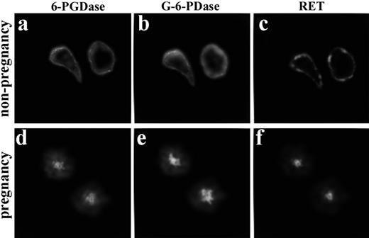 FIGURE 7. 6-PGDase and G-6-PDase exhibit RET in neutrophils from nonpregnant (a–c) and pregnant (d–f) women. Cells were fixed then stained with FITC-conjugated anti-G-6-PDase and TRITC-conjugated anti-6-PGDase. Although 6-PGDase and G-6-PDase are found at the periphery of nonpregnancy neutrophils (a and b) and at the MTOC of pregnancy cells (d and e), both types of cells exhibit RET (c and f). Magnification, ×820. n = 8.