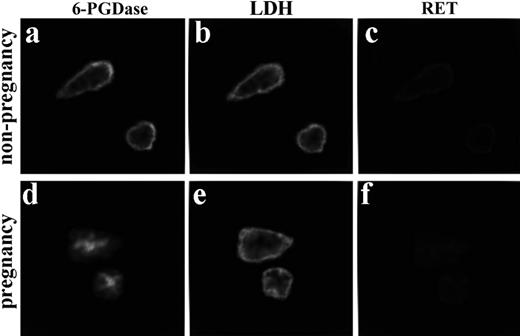FIGURE 9. 6-PGDase and LDH do not exhibit RET in both neutrophils from nonpregnant (a–c) and pregnant (d–f) women. Cells were fixed and then stained with FITC-conjugated anti-G-6-PDase and TRITC-conjugated anti-LDH. Although 6-PGDase and LDH are found at the periphery of nonpregnancy neutrophils (a and b), they do not exhibit RET, which suggests that they are not in close proximity. There different localizations in pregnancy cells is consistent with the absence of RET. Magnification, ×820. n = 3.