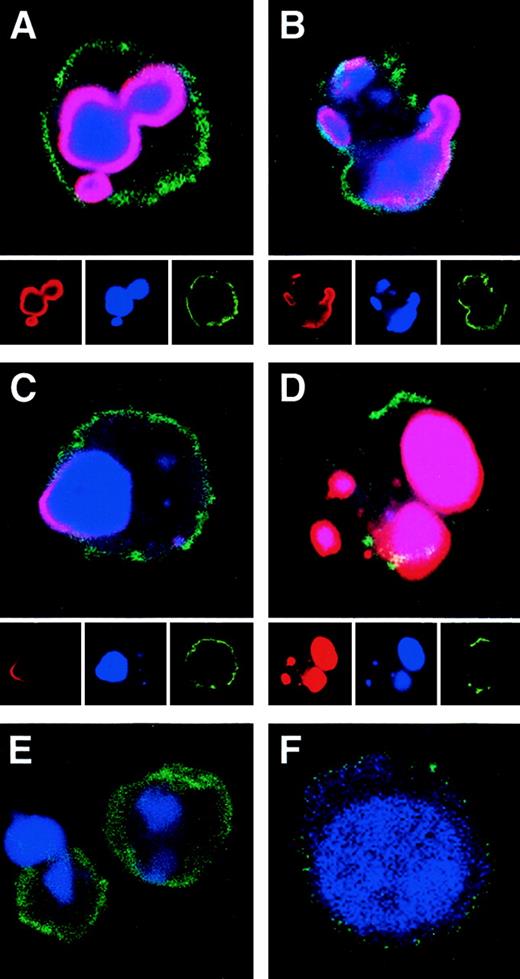 Nucleosomes Are Exposed at the Cell Surface in Apoptosis1 Biology Diagrams