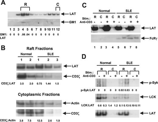 Alterations in Lipid Raft Composition and Dynamics Contribute to ...