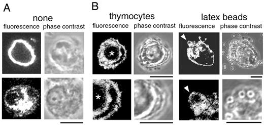 FIGURE 8. Association of TLR4 with phagosomes. RAW264.7 cells transfected with DNA expressing FLAG-tagged TLR4 were immunohistochemically examined for the localization of the tagged TLR4 using anti-FLAG Ab before (A) and after (B) phagocytosis reactions. Phase contrast and fluorescence views of the same microscopic fields are shown. The scale bars represent 10 μm. A, Examples of cells showing surface (top) and perinuclear (bottom) distribution of the tagged TLR4 are shown. B, Examples of engulfed thymocytes and latex beads are indicated by an asterisk and an arrowhead, respectively. The bottom panels are magnified views of the corresponding top panels.