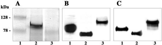 FIGURE 1. Immunochemical characterization of megalin-derived recombinant fragments. A, Coomassie Blue-stained SDS-PAGE showing molecular mass standards (lane 1), nM60GST (lane 2), and nM60s (lane 3). B, Western blot of nM60s (lane 1) and nM60i (lane 2) developed with anti-His6-HRP and of nM60GST developed with anti-GST-HRP (lane 3). C, Immunoblots of nM60s, nM60i, and nM60GST (lanes 1, 2, and 3, respectively) stained with rabbit anti-megalin antiserum.