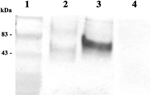 FIGURE 6. Lectin blot analysis of recombinant megalin fragments. Intracellular and secreted baculovirus products nM60i (lane 2) and nM60s (lane 3) and bacterially expressed nM60GST (lane 4) were run on SDS-PAGE under reducing conditions, transferred to nitrocellulose membranes (see Materials and Methods), and blotted with Con A-HRP at a 1/10,000 dilution. The molecular mass standards (lane 1) indicates the level of nonspecific staining under the blotting conditions.
