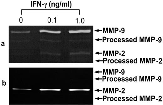 FIGURE 5. Up-regulation of the MMP-9 in macrophages and MMP-2 in SMC by IFN-γ treatment. a, Mouse peritoneal macrophages were cultured on collagen-coated plates and exposed to rmIFN-γ for 24 h at concentration of 0, 0.1, and 1.0 ng/ml. Conditioned media was separated on a 10% SDS-PAGE containing 0.8% gelatin for determination of MMP-9 content; b, human aortic SMC were cultured in M-199 medium and treated with hIFN-γ for 24 h at concentration of 0, 0.1, and 1.0 ng/ml. Conditioned media was separated on a 10% SDS-PAGE containing 0.8% gelatin for determination of MMP-2 content. The gel is representative of three experiments with similar results.
