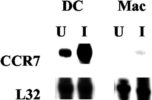 FIGURE 1. Mtb induces CCR7 up-regulation in DCs. Bone marrow-derived DCs or Macs (2 × 106 cells/ml each) were infected with the Erdman strain of Mtb for 6 h (U, Uninfected; I, 1:3 multiplicity of infection of Mtb), following which the cells were harvested, and total RNA was extracted. RNase protection assay analysis was performed by hybridizing RNA to a BD PharMingen (San Diego, CA) custom template, which contained sequences for CCR7 and L32 (housekeeping gene). Data shown are representative of two independent experiments.