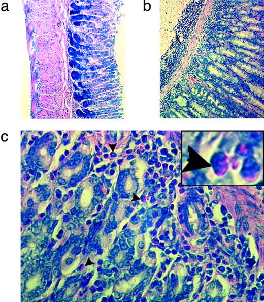 FIGURE 3. AIG in A51 Tg mice. Paraffin-embedded sections of stomach from a non-Tg animal (a) and a 12-wk-old A51 animal (b) were stained with Giemsa (magnification, ×20). A section from the same A51 animal observed at higher magnification is shown in c. Infiltrating eosinophils are indicated by arrows. A blow-up of a cluster of eosinophils is shown in the inset.