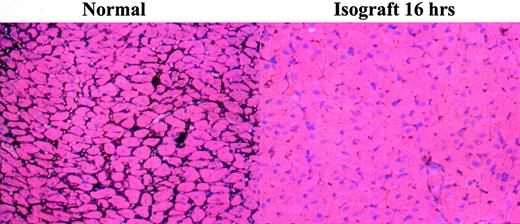 FIGURE 2. Loss of heparan sulfate following transplantation. Heparan sulfate detected by colloidal gold staining is lost from cardiac isografts taken at 16 h posttransplant.