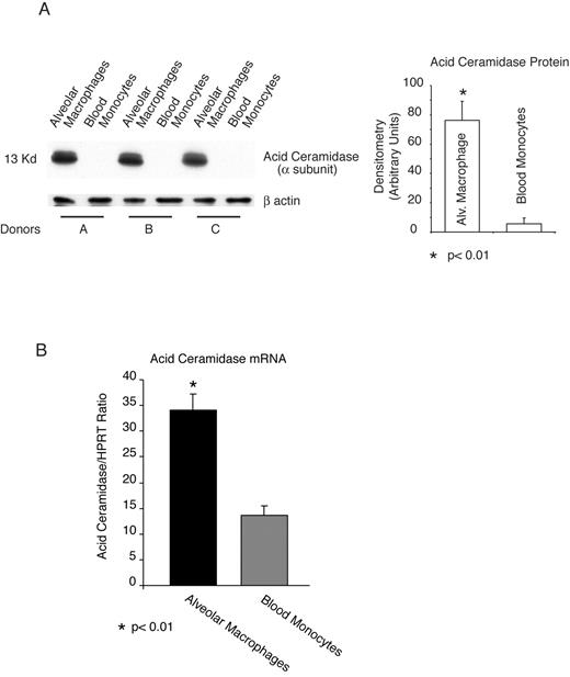 FIGURE 3. Human alveolar macrophages contain high amounts of acid ceramidase mRNA and protein. Matching sets of human alveolar macrophages and blood monocytes were obtained from normal volunteers as described in Materials and Methods. A, Whole-cell protein was obtained shortly after isolation, and Western analysis was performed for the small a subunit of acid ceramidase. Densitometry was obtained on the film, and the graph represents the three separate experiments. Equal loading is demonstrated by probing an identical blot for β-actin. B, mRNA was isolated from matching pairs of alveolar macrophages and blood monocytes by real-time RT-PCR. Acid ceramidase levels (three separate experiments) are shown as a comparison with the housekeeping gene HPRT. HPRT levels were comparable between alveolar macrophages and blood monocytes.