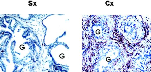 FIGURE 5. Castration induces prostate infiltration by T cells. Photomicrographs of prostates (magnification ×400) from Sx and Cx mice stained with anti-CD3 Ab. Prostates from 4-wk Sx and Cx mice were harvested and processed, as described in Materials and Methods. Note the castration-induced increased infiltration of the prostate by CD3+ cells adjacent to atrophic glands (right), compared with a few scattered CD3+ cells within the prostates of Sx mice (left). G, Denotes gland. Figures are representative of three independent experiments, each including cohorts of five 8- to 10-wk-old C57BL/6 mice.