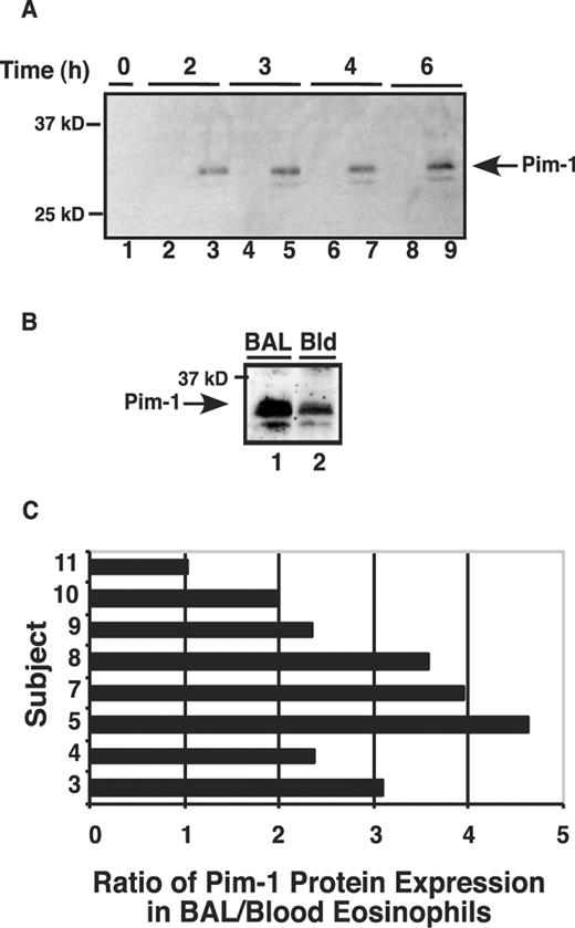 FIGURE 5. Protein expression of the STAT-dependent target Pim-1. A, Blood eosinophils were stimulated with 0 pM (lanes 1, 2, 4, 6 and 8) or 100 pM IL-5 (lanes 3, 5, 7 and 9) for the times indicated. Eosinophils were lysed, and 50 μg of lysate protein was immunoblotted with anti-Pim-1 Ab (Santa Cruz Biotechnology; sc-13513). This experiment was performed seven times, and similar results were observed using eosinophils obtained from allergic asthmatic and nonasthmatic patients. B, Pim-1 protein expression in BAL (lane 1) or blood (Bld) (lane 2) eosinophils collected 48 h after segmental bronchoprovocation with Ag from an allergic asthmatic patient. Data shown are from eosinophils of subject 3 in Table I. C, Summary of the relative expression of Pim-1 protein, as determined by immunoblotting and densitometry analysis, for eight subjects for whom there was detectable Pim-1 protein in both blood and BAL eosinophils acquired 48 h after segmental bronchoprovocation with Ag. One additional patient (patient 6 in Table I) had no detectable Pim-1 protein in either blood or BAL eosinophils. The expression of Pim-1 protein was significantly greater (n = 9, p = 0.0015) in BAL eosinophils. The characteristics of these subjects are listed in Table I.