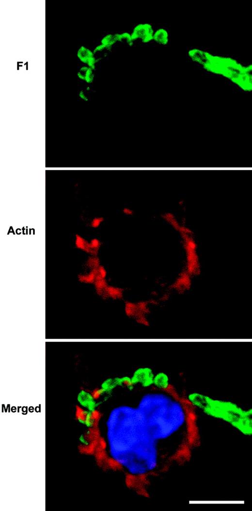 FIGURE 1. Intracellular infection of human primary monocytes with Y. pestis. Monocytes (CD14+) were infected with Y. pestis (50 bacteria/cell) for 1 h at 37°C. Cells were then fixed, permeabilized, and stained with primary mouse anti-F1 Ab, followed by secondary goat anti-mouse FITC-conjugated Ab to detect bacteria and Texas Red-conjugated phaloidin for cellular actin, and examined under confocal microscopy. Bar = 5 μM.