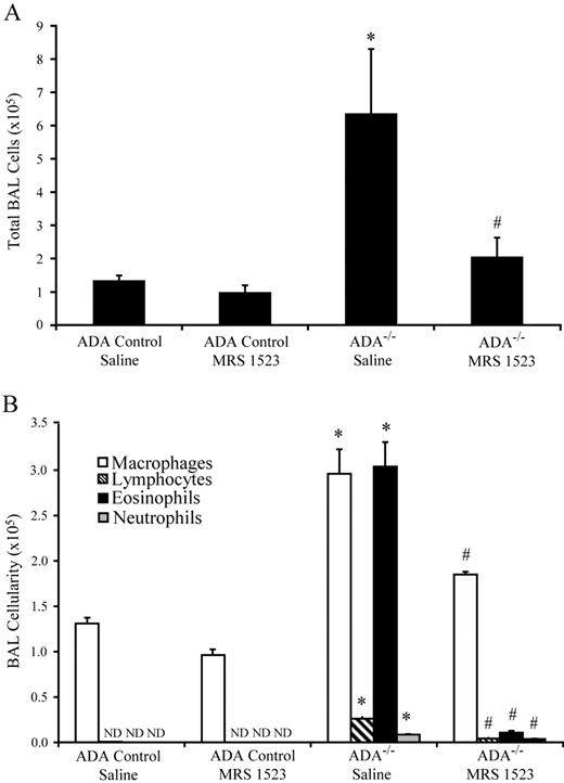 FIGURE 5. MRS 1523 treatment decreases the number of eosinophils in the BALF of ADA−/− mice. ADA control and ADA−/− mice were implanted with osmotic pumps as described in Materials and Methods. A, At 29–31 days of age, the total number of cells recovered from the BALF was determined. Values are given as mean total cell counts × 105± SEM (∗, p ≤ 0.05, Student’s t test). B, Cellular differentials were determined on aliquots of cells from 29 to 31-day-old ADA control and ADA−/− mice treated with saline or MRS 1523. Values are given as mean total cell counts × 105± SEM, n = 5. (∗, p ≤ 0.05 ADA−/− saline vs ADA control saline; #, p ≤ 0.05 ADA−/− MRS 1523 vs ADA−/− saline using a Student’s t test).